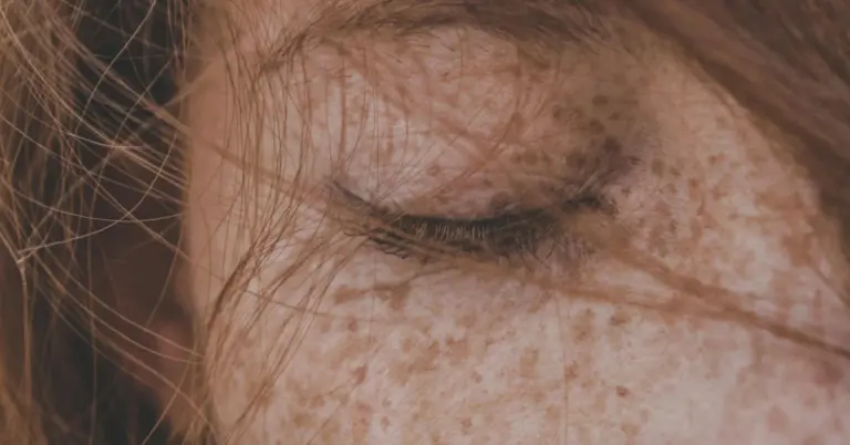 Close-up of freckled facial skin with a closed eye and wispy hairs.