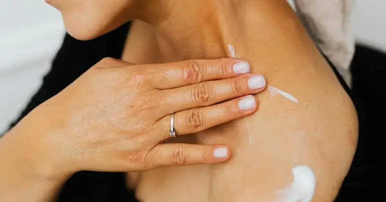 Close-up of a hand applying white numbing cream to a shoulder before laser tattoo removal