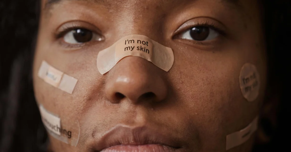 Close-up of a person’s face with several adhesive bandages applied to the nose and cheeks, including a bandage on the nose that reads 'I’m not my skin', illustrating post-tattoo bandage care.