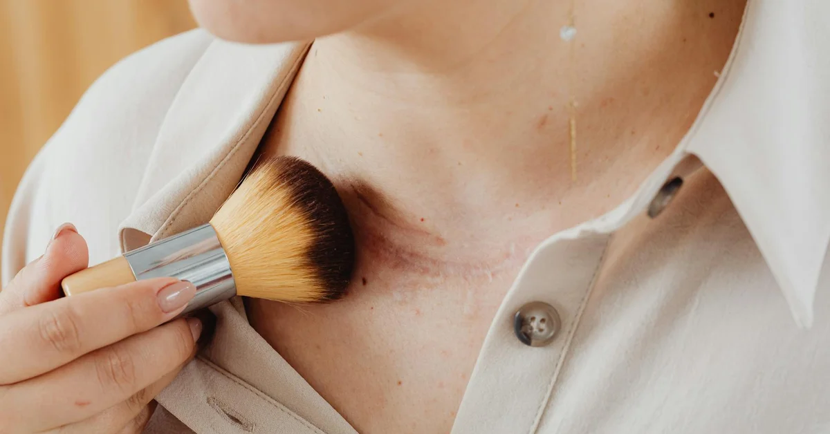 The Naked Truth: What Your Skin Really Looks Like After Tattoo Removal