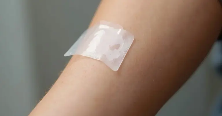 Close-up of a clear Tegaderm adhesive patch applied to the skin on an arm, used for tattoo removal aftercare.