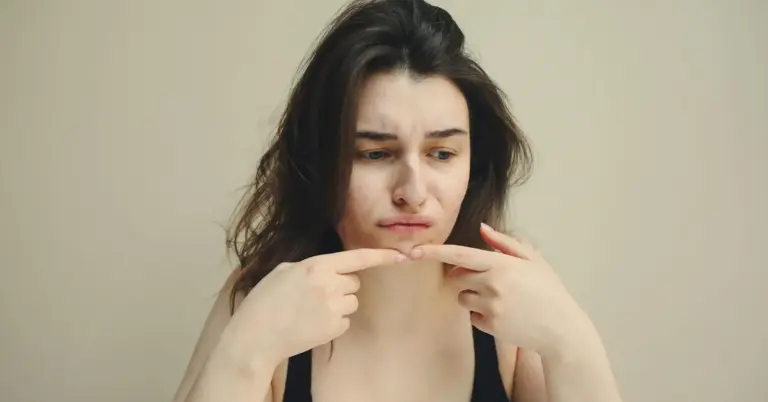 Woman gently touching her chin and looking down, appearing thoughtful about skin concerns on her face.